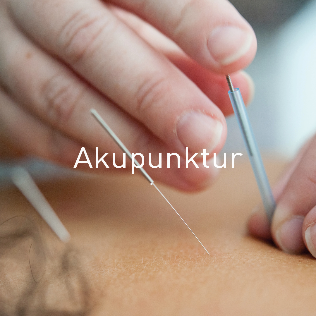 mothership-akupunktur-acupuncture-1