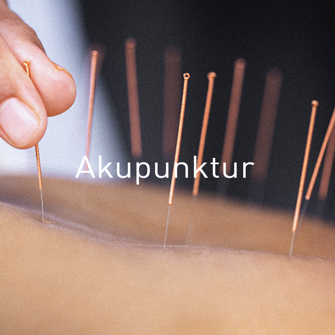 mothership-akupunktur-acupuncture2